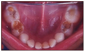 sg-children-1-before