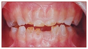 sg-children-2-before