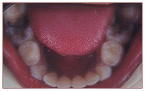 sg-children-3-before